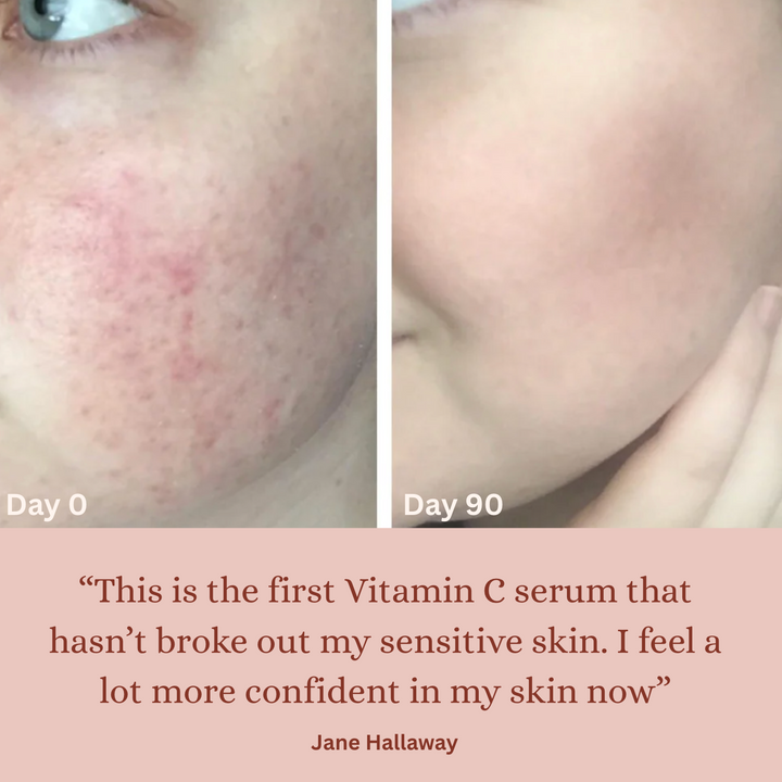 Clear Glow Stabilized Vitamin C Serum
